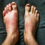 শরীরে ঘন ঘন ফোলা ও তীব্র ব্যথা, এর কারণ কি কি হতে পারে, জানুন