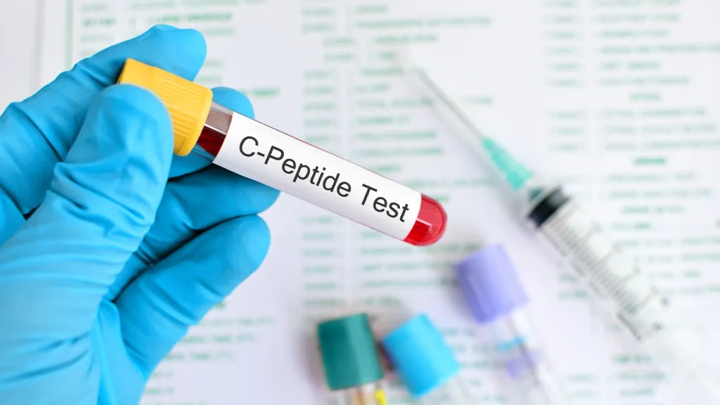 C-peptide পরীক্ষা কি এবং এটি প্রতিটি ডায়াবেটিস রোগীর জন্য কেন অপরিহার্য?