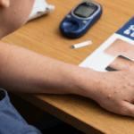 এই ত্বকের লক্ষণগুলোকে উপেক্ষা করবেন না, এগুলো ডায়াবেটিসের লক্ষণ হতে পারে