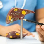 ফ্যাটি লিভারের ক্ষেত্রে ঘি এবং তেল কি সম্পূর্ণরূপে এড়িয়ে চলা উচিত? একজন বিশেষজ্ঞের কাছ থেকে জেনে নিন