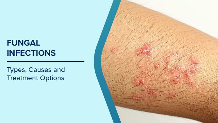 ত্বকের বারবার সংক্রমণ কোন রোগের ইঙ্গিত দেয়? জানুন এর কারণ ও প্রতিকার সম্পর্কে