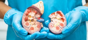 প্রস্রাবে রক্ত​থাকা কি কিডনি ক্যান্সারের লক্ষণ হতে পারে? চিকিৎসকরা জানাচ্ছেন কখন এটি চিন্তার বিষয়