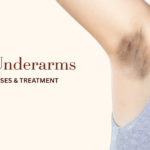 আন্ডারআর্ম কেন কালো হয়ে যায়? এগুলো কি পুনরুদ্ধার করা সম্ভব? জানুন
