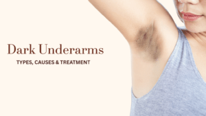 আন্ডারআর্ম কেন কালো হয়ে যায়? এগুলো কি পুনরুদ্ধার করা সম্ভব? জানুন