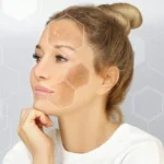 ত্বকের পিগমেন্টেশন বা রঞ্জকতার কারণ কি? এটি প্রতিরোধ করবেন কীভাবে?