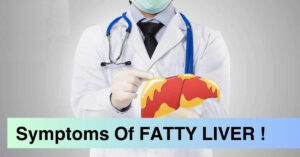 ফ্যাটি লিভার কখন বিপজ্জনক হয়ে ওঠে? জানুন এর লক্ষণ, কারণ এবং কখন চিকিৎসকের পরামর্শ নেওয়া জরুরি