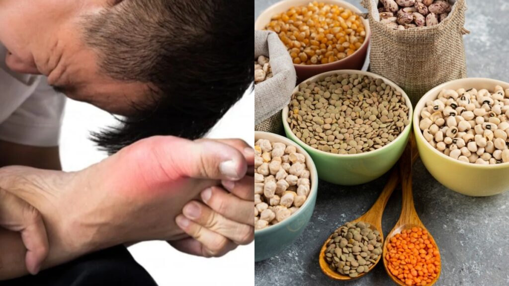 আপনার কি ইউরিক অ্যাসিডের মাত্রা বেশি? খালি পেটে এই জিনিসগুলো খান।