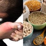 আপনার কি ইউরিক অ্যাসিডের মাত্রা বেশি? খালি পেটে এই জিনিসগুলো খান।