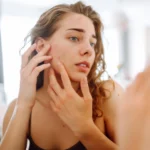 দামি চিকিৎসার ছাড়ুন! ব্ল্যাকহেডস ও হোয়াইটহেডস থেকে মুক্তি পান—শুধু ব্যবহার করুন এই ৩টি উপাদান