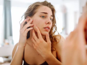 দামি চিকিৎসার ছাড়ুন! ব্ল্যাকহেডস ও হোয়াইটহেডস থেকে মুক্তি পান—শুধু ব্যবহার করুন এই ৩টি উপাদান