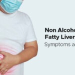 নন-অ্যালকোহলিক ফ্যাটি লিভার ডিজিজ কি? কারা ঝুঁকিতে আছেন?