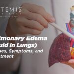 ফুসফুসে তরল জমা কতটা বিপজ্জনক? এমনটা কেন ঘটে? — বিশেষজ্ঞদের কাছে জানুন