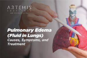 ফুসফুসে তরল জমা কতটা বিপজ্জনক? এমনটা কেন ঘটে? — বিশেষজ্ঞদের কাছে জানুন