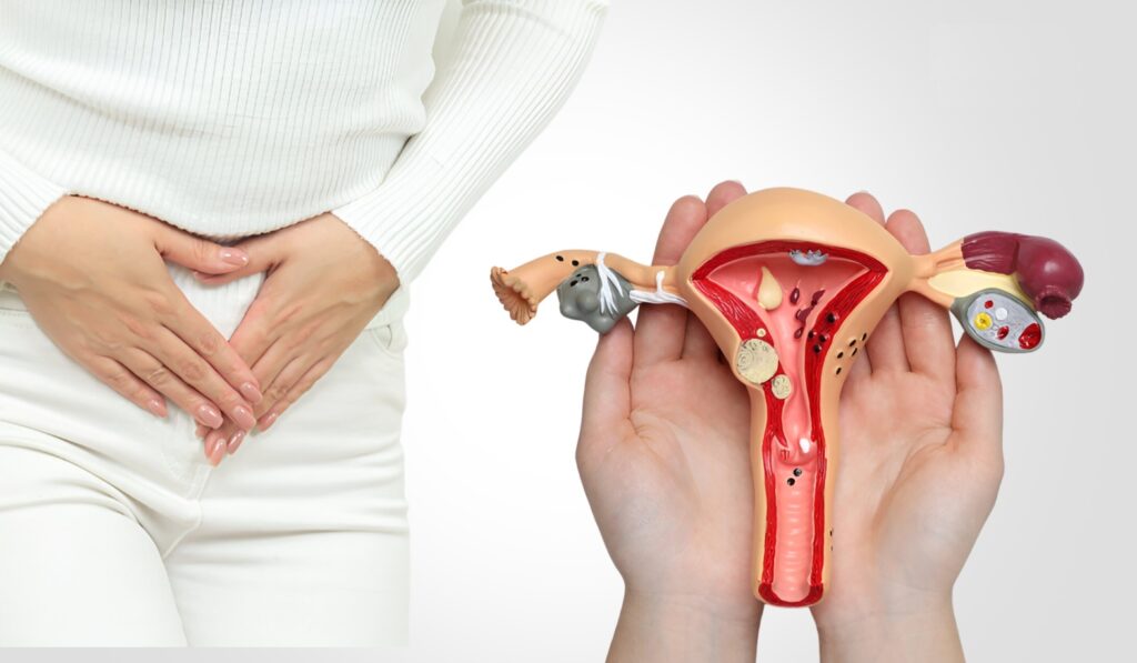 নারীদের মধ্যে pcos-এর প্রধান কারণ কি? এটি কীভাবে বন্ধ্যাত্বের দিকে নিয়ে যায়?